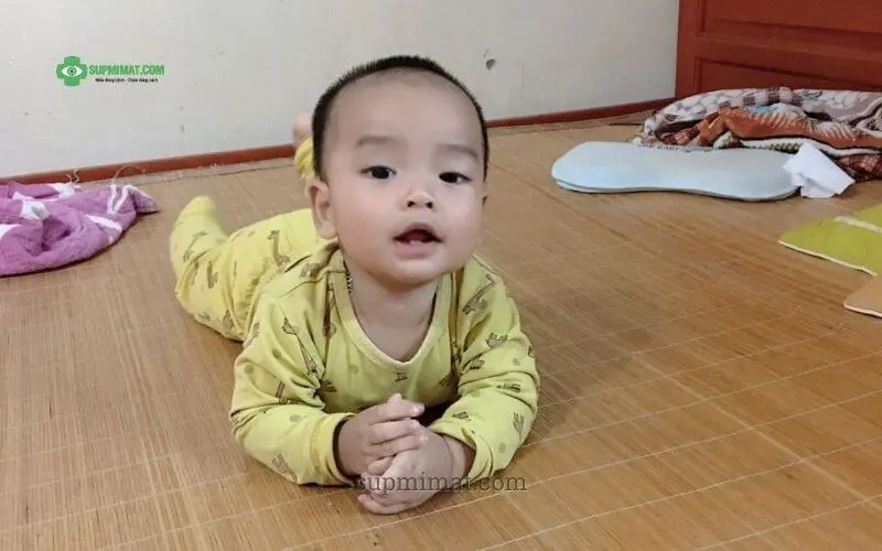 Trang chủ Sụp mí mắt Bẩm sinh